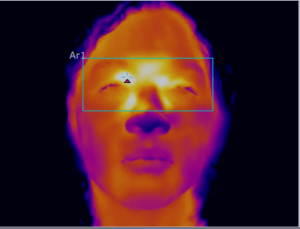 fever infrared thermal imaging