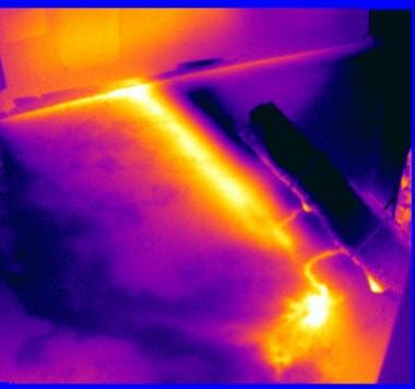 Thermal Imaging Home Inspection Brooklyn - Infrared Home Inspections